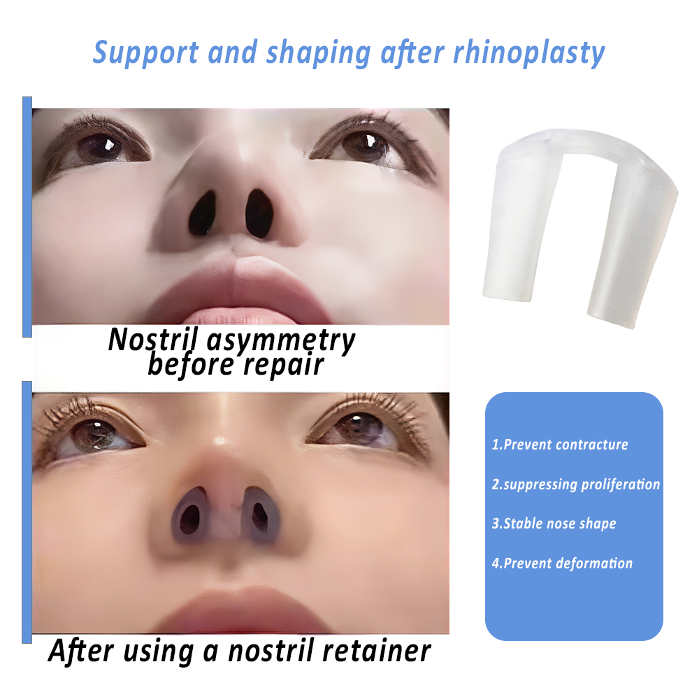 Neusvormgever voor herstel na  - Anti Snore Contour Pillow recensie en prijs