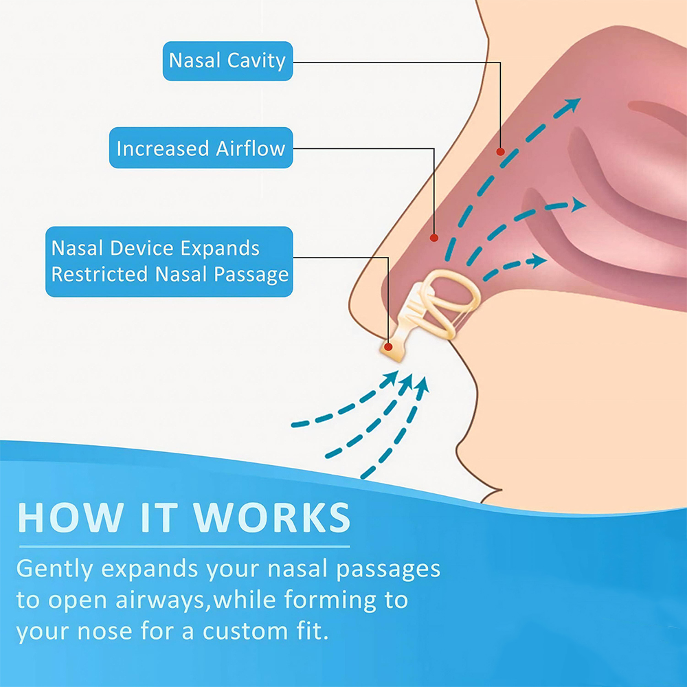 Anti Snurken Neus Dilatator St - Anti Snore Contour Pillow recensie en prijs